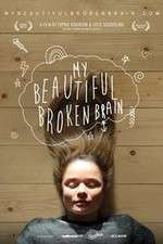 Watch My Beautiful Broken Brain 9Movies